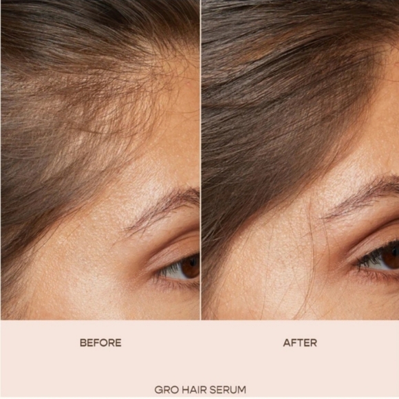 *SEALED* Vegamour GRO Hair Serum - Picture 6 of 11